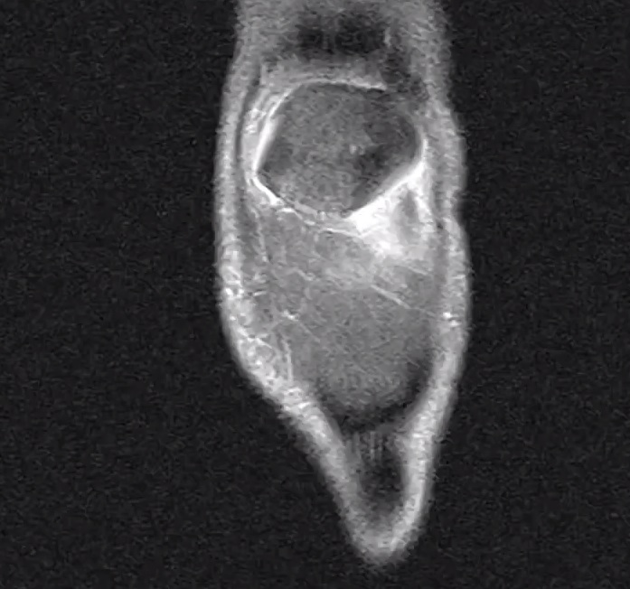 Chris Cohen - "Monad" Video