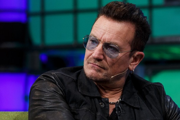 Bono Reviews His Year A To Z, Shares X-Ray Of His Titanium Elbow