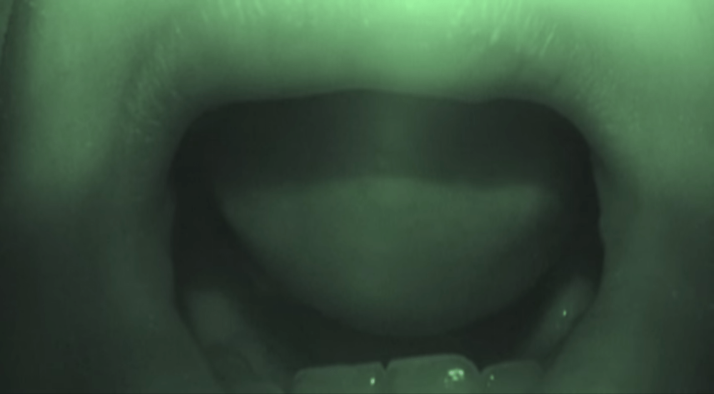 Vision Fortune - "Back Crawl II" Video