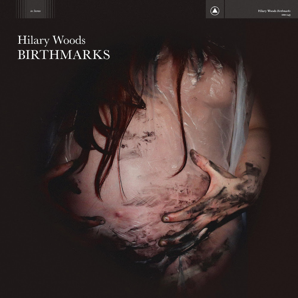 Hilary-Woods-Birthmarks