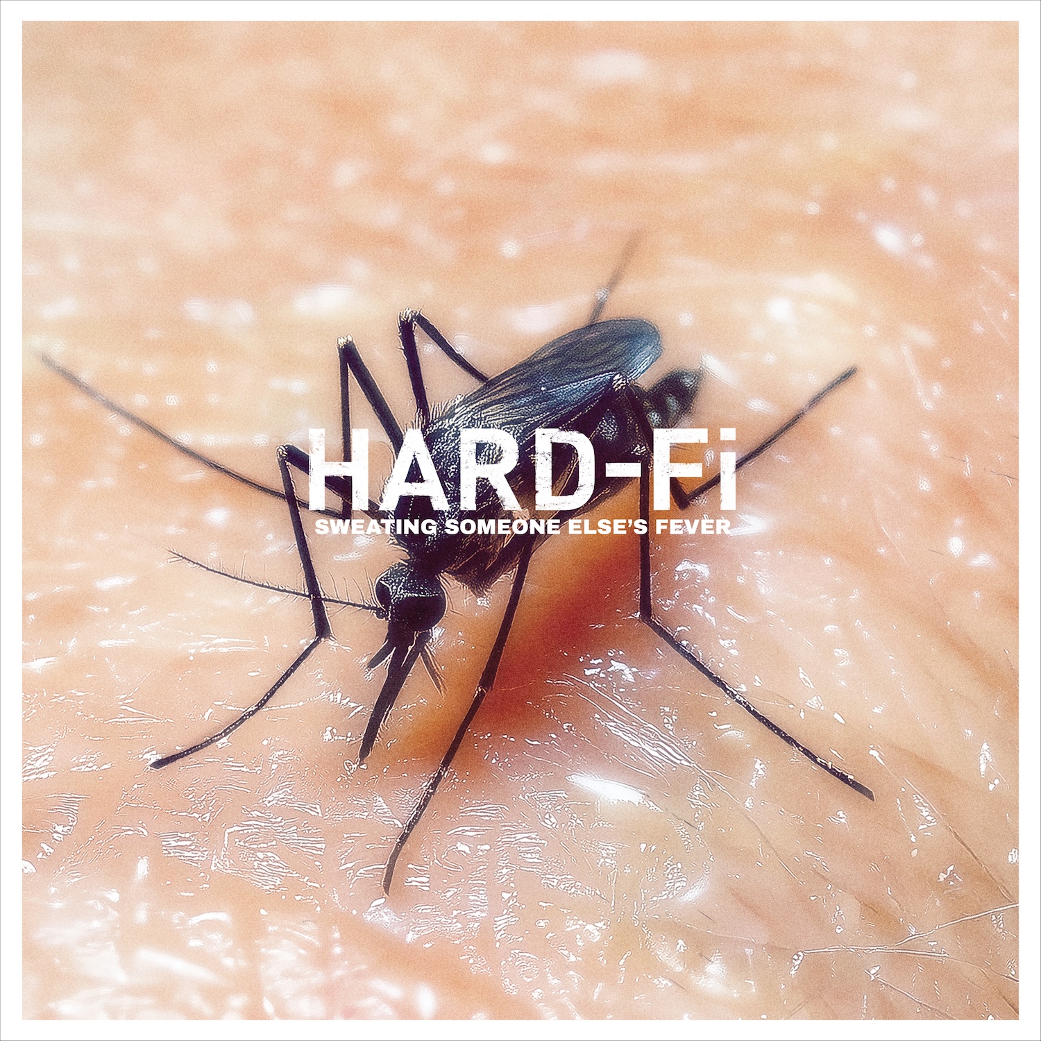 Hard-Fi Announce First New Album In 15 Years Sweating Someone Else’s Fever: Hear “They Ain’t Your Friends”