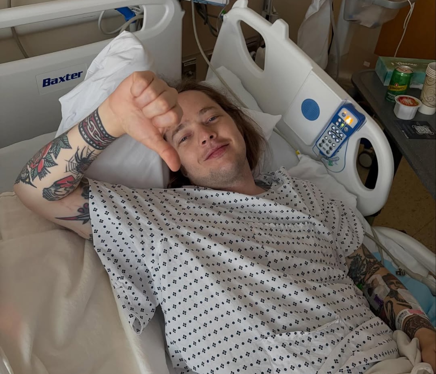 Billy Strings Breaks Leg Skateboarding During Charlottesville Show